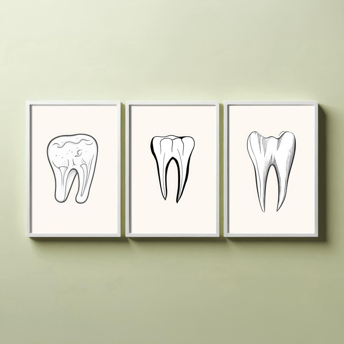 Tooth Drawing Set of Three Art Prints - Line Art Molars on White Background - Dentist Office Poster - Minimalist Dental Decor